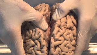 Introduction Neuroanatomy Video Lab  Brain Dissections [upl. by Leasa]