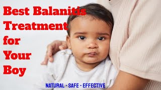 Balanitis the Best Treatment for Children [upl. by Ahsot]