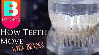 BRACES EXPLAINED How Teeth Move  Braces Work [upl. by Wrand201]