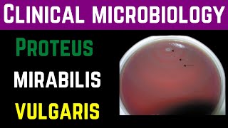 Proteus Mirabilis amp Vulgaris ClinicalPathogenesisInvestigationTreatmentPrevention  Dr Mubashar [upl. by Stanton]