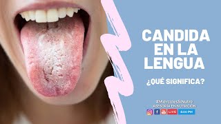 ¿Cándida en la lengua Descubre lo que significa👅🔎 [upl. by Mayap]