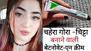 Betnovate N Cream Complete Review हिन्दी मैं Betnovate N Cream Uses amp Side effects [upl. by Nedaj403]