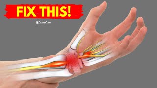 How to Fix Wrist Pain for Good [upl. by Aramit829]