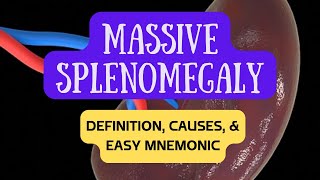 Massive Splenomegaly Enlarged Spleen  Definition Causes and Easy Mnemonic [upl. by Liahkim]