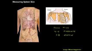 Measuring Spleen Size  Clinical Skills Made Easy [upl. by Carol260]