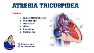 ATRESIA TRICUSPÍDEA CARDIOPATÍA CONGÉNITA [upl. by Belvia]