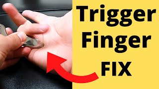 FIX Trigger Finger in 5 Minutes 3 Steps [upl. by Nessej]