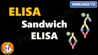 Sandwich ELISA FLImmuno72 [upl. by Havard]