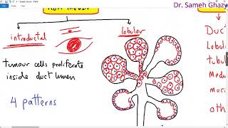 Fibroadenoma of Breast  Symptoms Diagnosis amp Treatment of Breast Lumps [upl. by Enilauqcaj120]