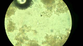 Milk to Curd by Lactobacillus Bacteria Microscopic View [upl. by Marcela]