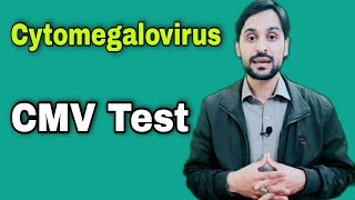 CMV Test  Cytomegalovirus Test [upl. by Burrton]