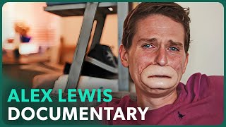 The Extraordinary Case of Alex Lewis [upl. by Asaret]