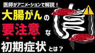 絶対に見逃してはならない大腸がんの初期症状4選 [upl. by Gelya]