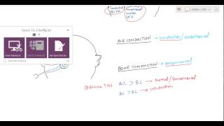 Weber and Rinne Tuning Fork tests for USMLE [upl. by Dnalevelc]