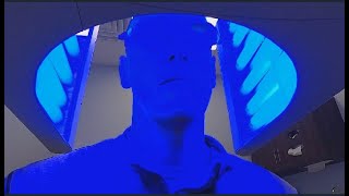 PHOTODYNAMIC THERAPY ”BLUE LIGHT” Im getting my face burned off [upl. by Hseham]