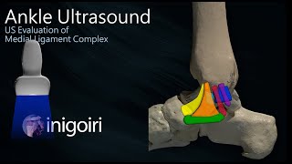 ANKLE ULTRASOUND MEDIAL LIGAMENT COMPLEX EVALUATION [upl. by Gisele679]