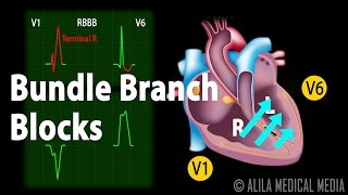 Bundle Branch Block Animation [upl. by Azpurua823]