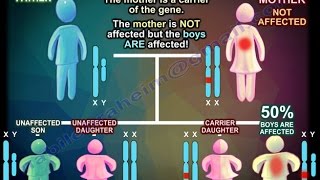 X Linked Recessive Inheritance  Everything You Need To Know  Dr Nabil Ebraheim [upl. by Healion]