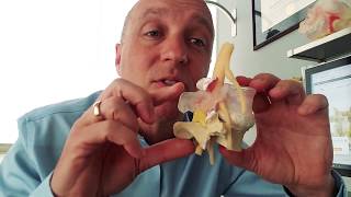 Lumbar Degenerative Disc Disease  Part 3 Surgical Treatments The quotTiger Woodsquot Surgery [upl. by Phelgen]