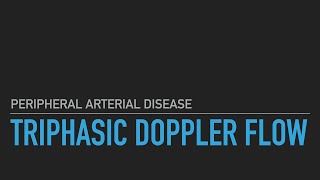 Triphasic Doppler Flow [upl. by Nitfa]