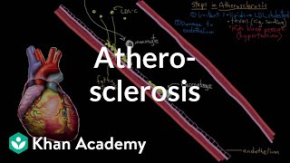 Atherosclerosis  Circulatory System and Disease  NCLEXRN  Khan Academy [upl. by Dnumyar]