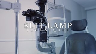 Ophthalmology Slit Lamp Techniques ubcmedicine [upl. by Bornie]