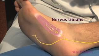 Motorische Neurographie  Tibialis [upl. by Enilra]