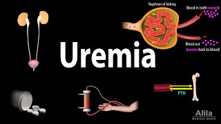 Uremia Pathophysiology Symptoms Diagnosis and Treatment Animation [upl. by Cilla403]