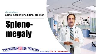 Spleenomegaly Enlarged Spleen  Causes Diagnosis Symptoms Treatment Prognosis [upl. by Secnarfyram]