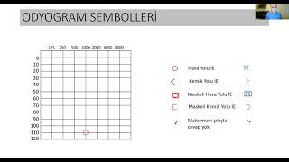 Odyogram Sembolleri [upl. by Kerrill]