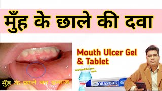 What are The Best Medicine For Mouth ulcer  Gel Mouthwash amp Tablets [upl. by Elletsyrk]