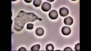 Neutrophil Phagocytosis  White Blood Cell vs Staphylococcus Aureus Bacteria [upl. by Charteris496]