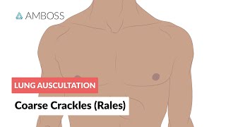 Coarse Crackles Rales  Lung Auscultation  Episode 3 [upl. by Erica]