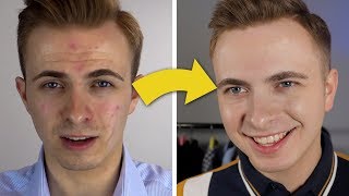 How I Transformed My Face  Best Mens Face Moisturizer [upl. by Cohbert]