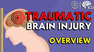 Overview of Traumatic Brain Injury TBI [upl. by Flem]