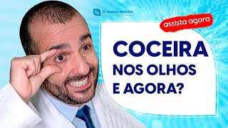 What I Learned from 100 Patients with Coceira nos Olhos Will Surprise You [upl. by Lhary765]