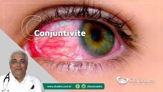 Conjuntivite  Dr Salim CRM 43163 [upl. by Orteip372]