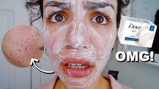 I USED DOVE SOAP ON MY FACE [upl. by Nudnarb]