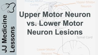 Upper and Lower Motor Neuron Lesions  UMN vs LMN Differences and Mnemonic [upl. by Monreal248]