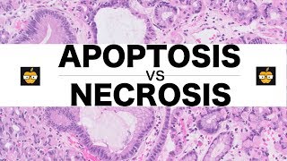 Apoptosis Intrinsic Extrinsic Pathways vs Necrosis [upl. by Raynold]