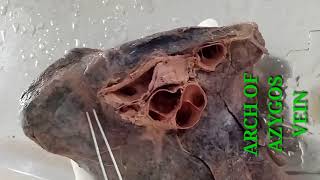 LUNGS PART2  ROOT AND RELATIONS  BY DR MITESH DAVE [upl. by Amatruda]