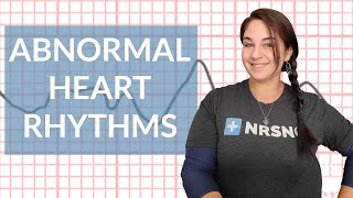 EKG like a BOSS Part 3  Abnormal Heart Rhythms [upl. by Lucie]