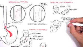 Hepatic portal system [upl. by Fairbanks]