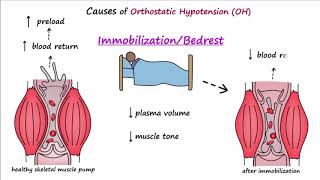 How to Perform Orthostatic Hypotension Testing [upl. by Strawn]