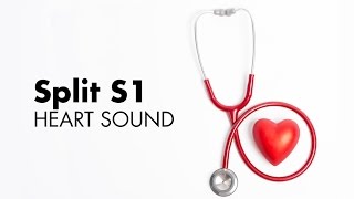 Split S1  Heart Sounds  MEDZCOOL [upl. by Wildon]