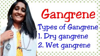 Gangrene types of gangrene  dry gangrene wet gangrene [upl. by Ateekram]