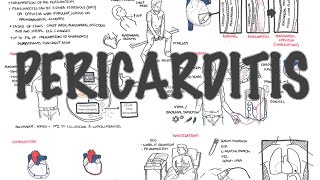 Pericarditis  Overview signs and symptoms pathophysiology diagnosis treatment [upl. by Adialeda560]