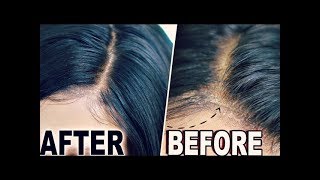 How To quotHIDE LACEquot amp Wig Cap Lace Wigs Fake Scalp Method  ORIGINAL CREATOR [upl. by Ytirahc]