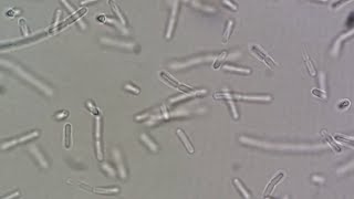 Bacillus spp [upl. by Efron]