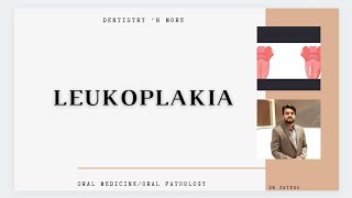 LEUKOPLAKIA [upl. by Pegma586]